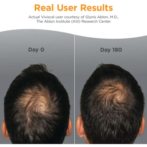 Viviscal Men's Hair Growth Supplement - 60 Tablets